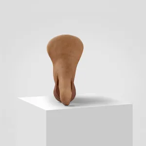 FTM STP - 3rd gen. uncircumcised