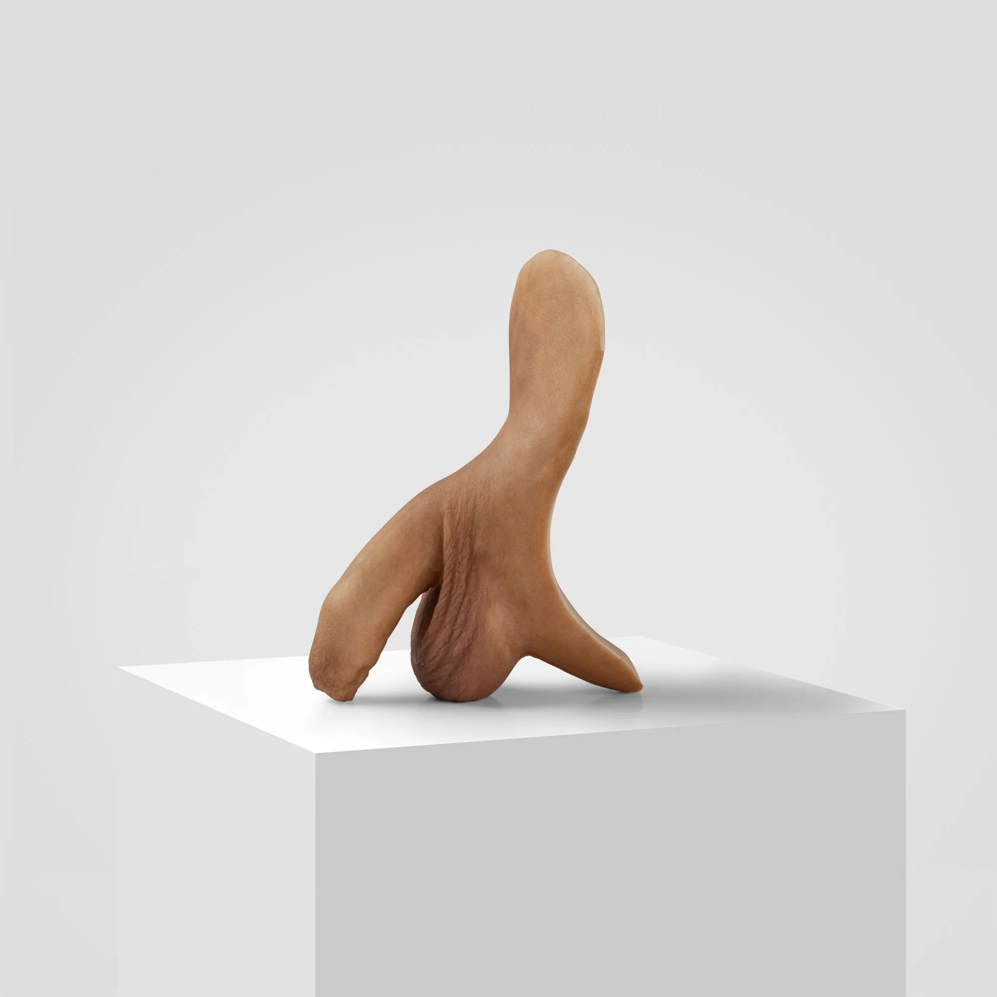 FTM STP - 3rd gen. uncircumcised